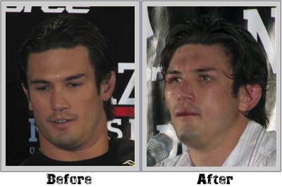 KJ Noons Before and after Strikeforce: KJ Noons Before and After Pictures
